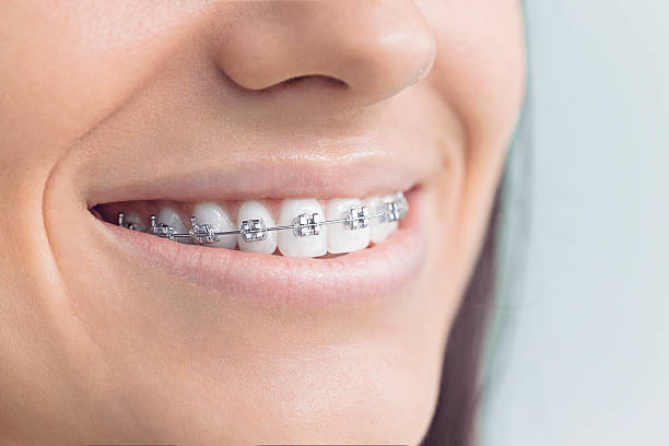 Best Teeth Whitening  in Hillcrest Heights, MD